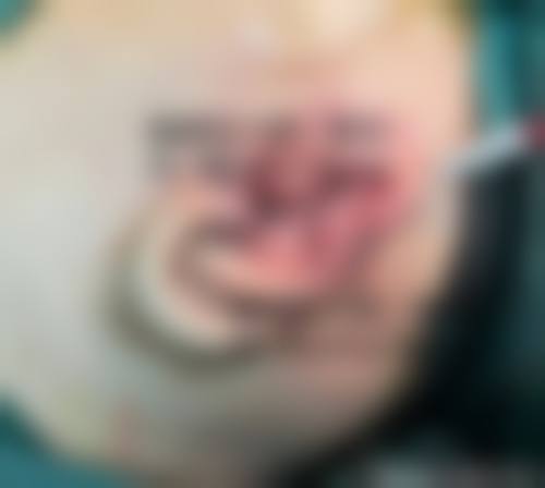 张会堂在哪家医院