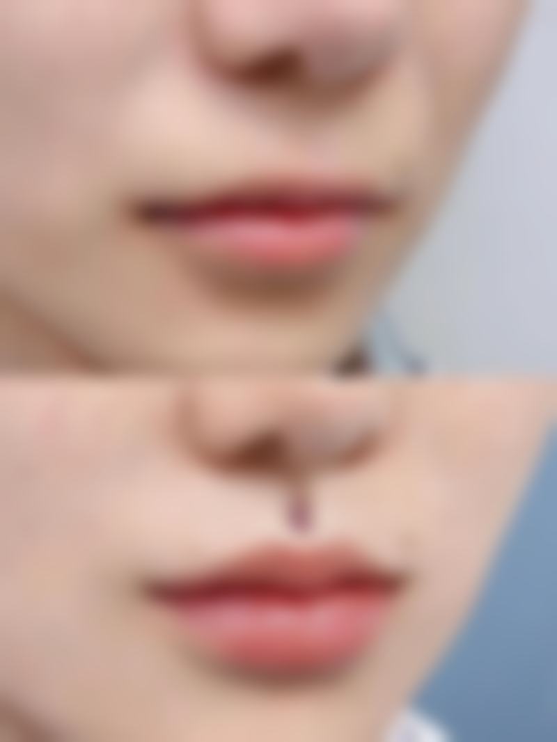 五、广州美贝尔医疗美容医院怎么预约：