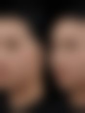 张会堂在哪家医院