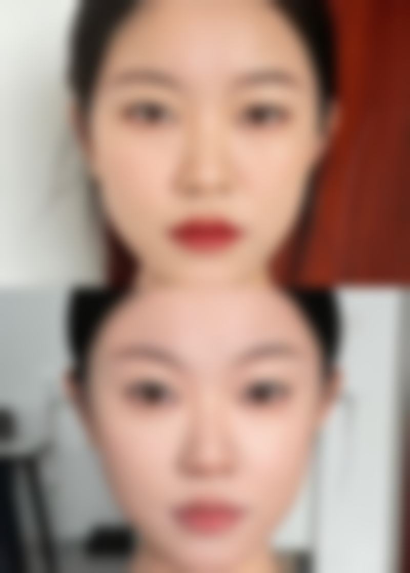 六、广州美贝尔医疗美容医院价格表：（仅供参考）