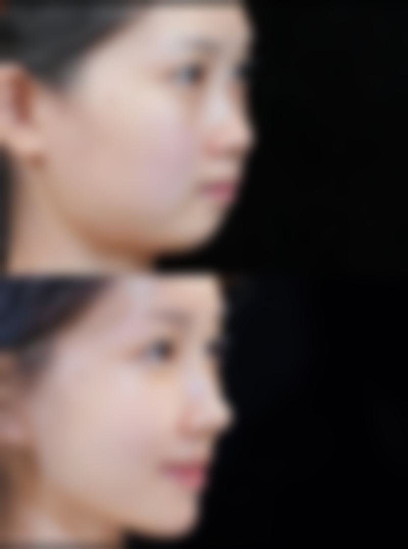 八、邯郸凯润婷医疗美容医院真实的顾客评价如下：