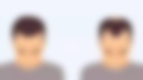 探寻成龙割双眼皮的神秘医院：专精团队实力强