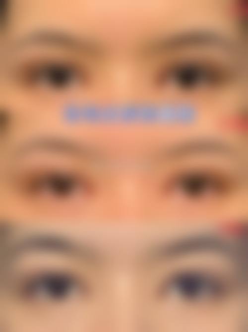 马战胜眼部整形水平怎么样可靠吗？