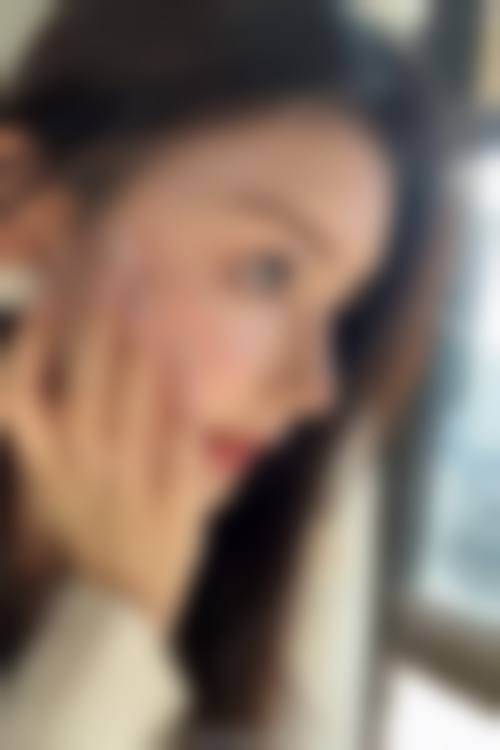 肖汉洲面部整形实例