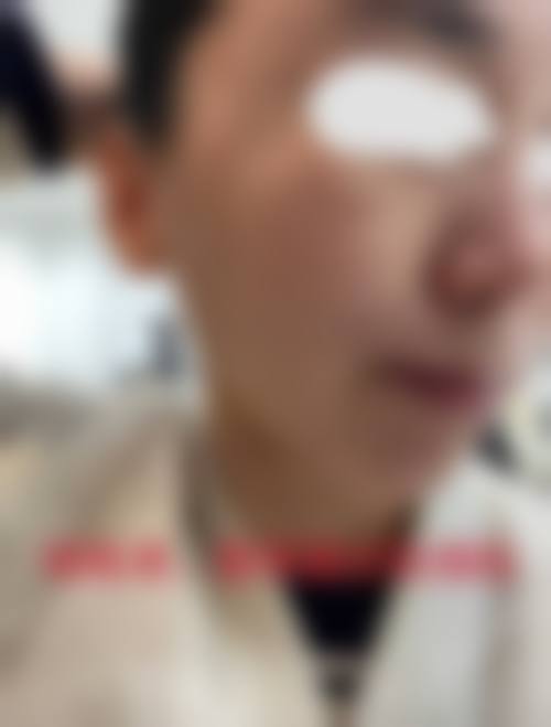 何泽星怎么预约？