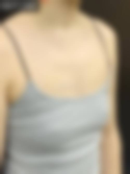 奉龙鼻综合手术实例