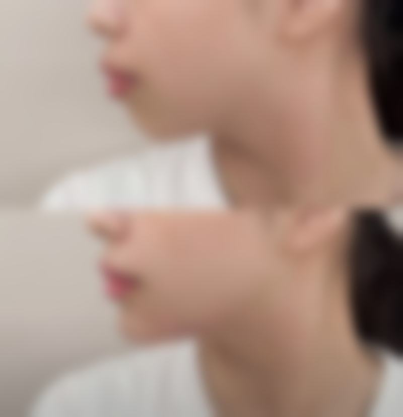 六、杭州睿妍医疗美容诊所怎么预约：