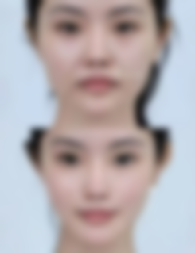 探寻成龙割双眼皮的神秘医院：揭秘具备先进设备与专业团队的整形圣地 