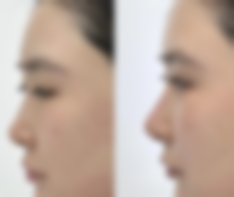 八、北京仁雁医疗美容门诊部真实的顾客评价如下：