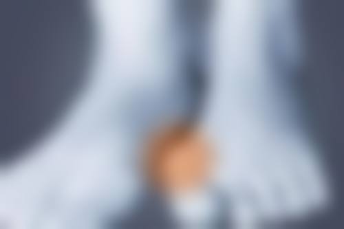 如何选择适合你的眼部整形医院，开启变得更美之旅