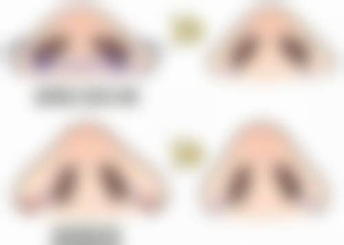 美杜莎双眼皮的技术实力强在哪？精细操作成就魅力双眸