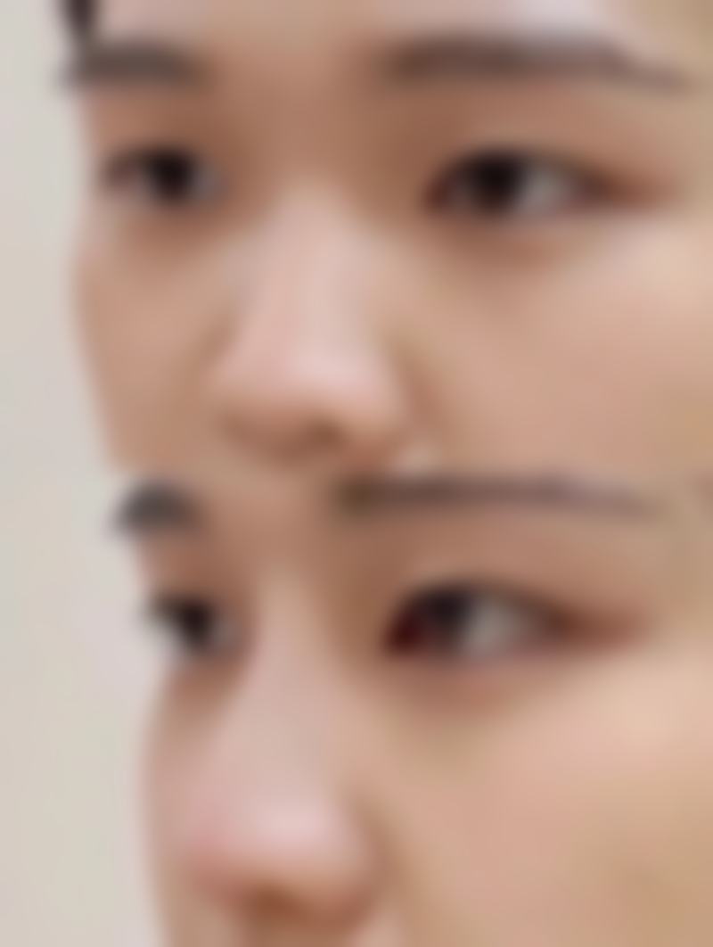 四、韩国Dodream整形外科实例