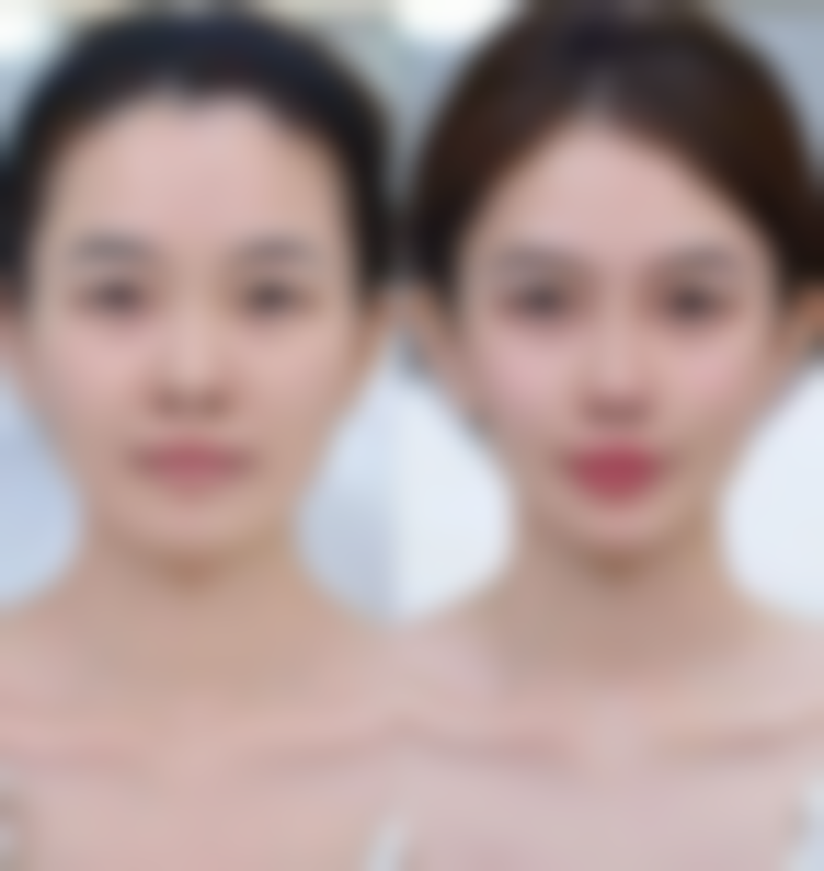 告别疤痕色素沉着难题！了解正规医院，放心治疗