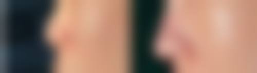 七、艾米纳尔医疗美容诊所 仙台院真实的顾客评价如下：