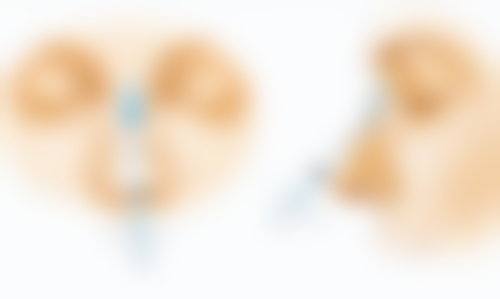 五、东莞虎门罗恩整形医院实例