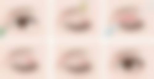 怎样微创拥有双眼皮？埋线与三点法显神通