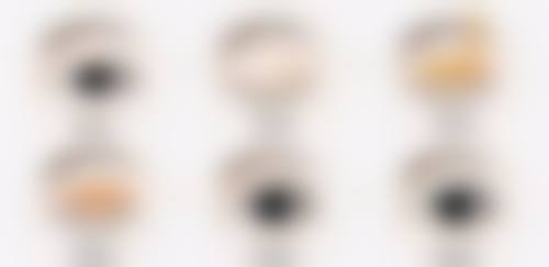 开双眼皮暗藏哪些危险？术后并发症大盘点