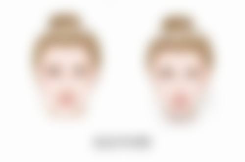 五、深圳颜伊医疗美容门诊部怎么预约：