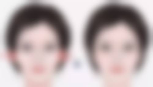 关于溶脂针消除眼袋,还有啥需要知道的?