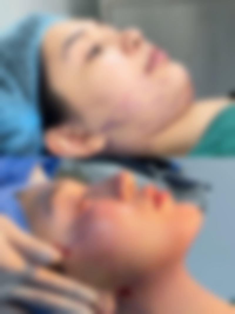 怎样去除缝针后的疤痕疙瘩？专精医院来助力