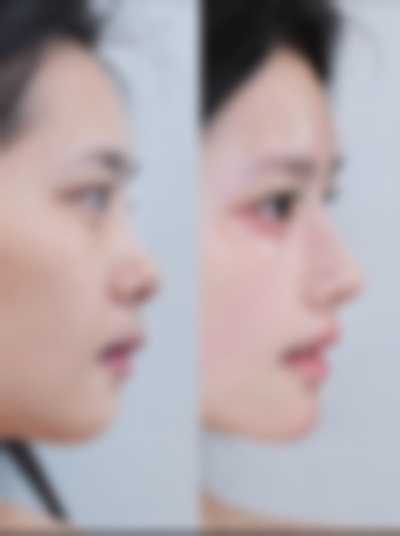 专精医生团队，为你的线提升问题保驾护航