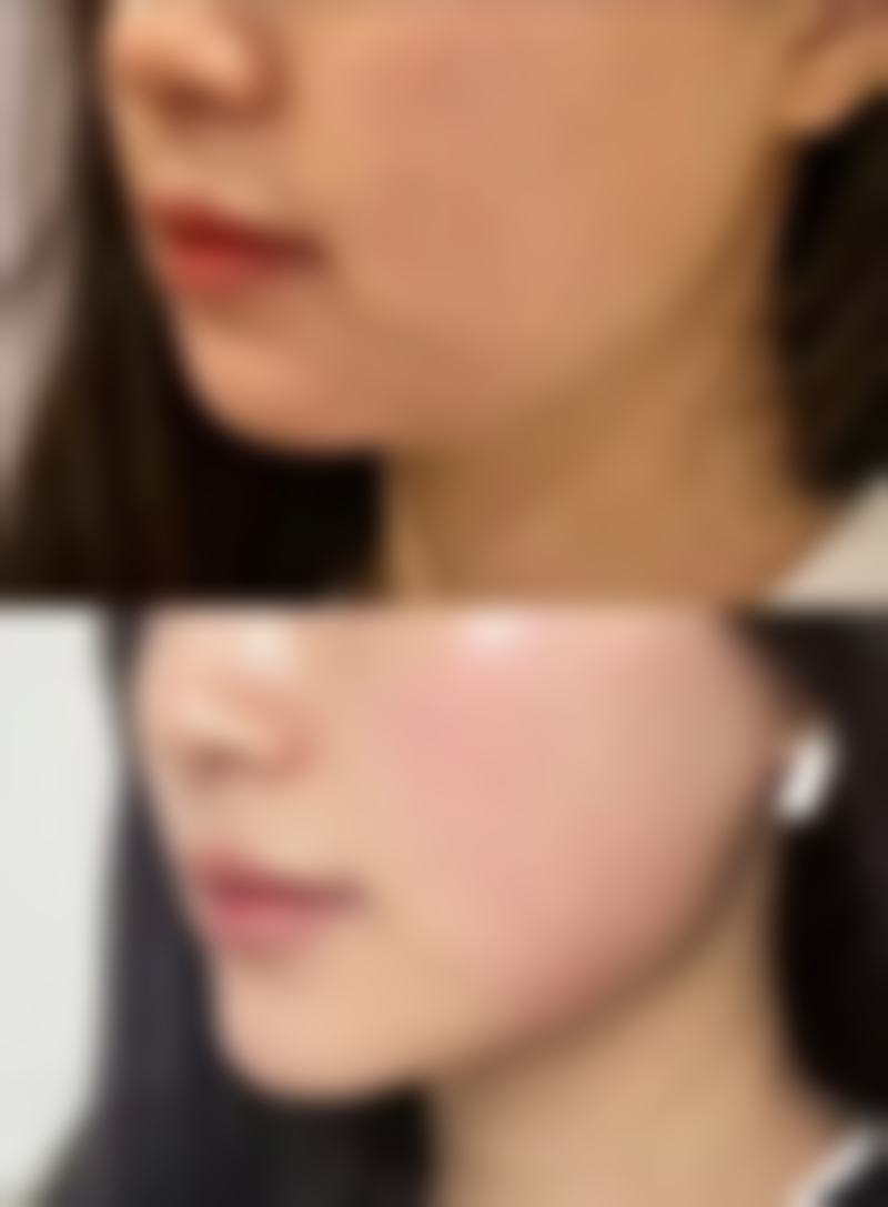 怎样选择靠谱医美机构？关键信息大揭秘