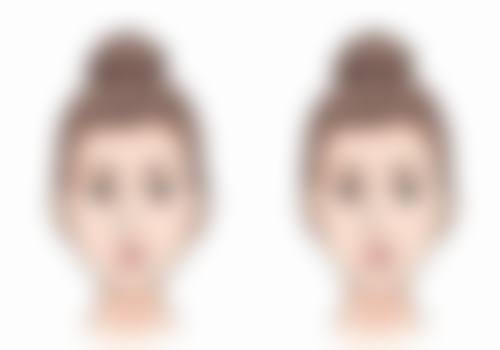 护理加速：做好术后护理，3 - 6个月快速变得更美不是梦