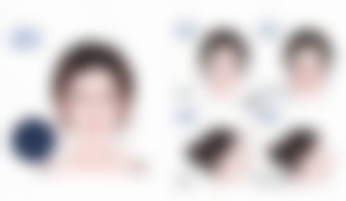 五、深圳倍生医疗植发怎么预约：