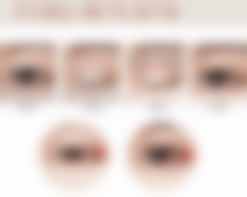 美妍高科去眼袋效果大揭秘！副作用几何？了解这些让你美眼无忧 