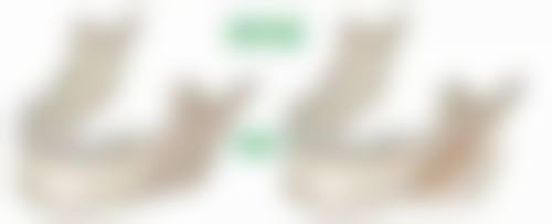 吸脂肪的奥秘之术后成效与注意事项