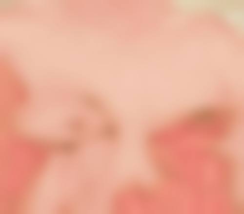 双眼皮术后3个月能否修复？综合评估恢复情况，6个月后修复效果更可控 