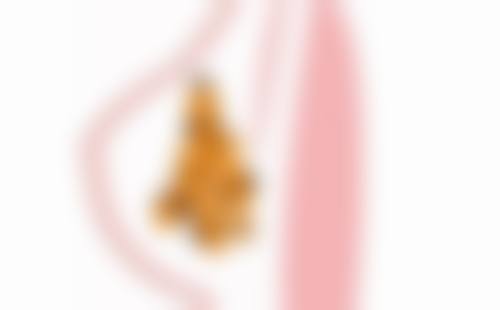 隆鼻两年遭撞击:选择专精医院修复有保护