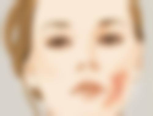 VE去除眼袋的具体优势：好处多多