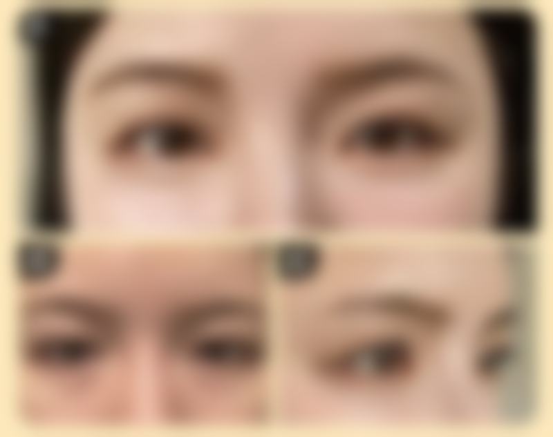 巧用茶叶消眼袋之敷眼方法全攻略