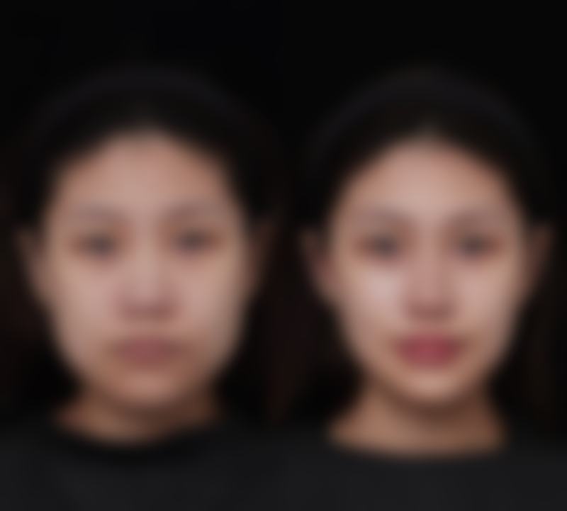 五、威海鑫致美整形医院怎么预约: