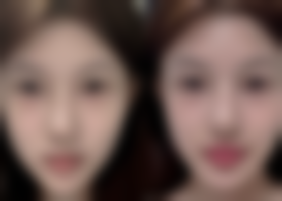 七、威海鑫致美整形医院真实的顾客评价如下: