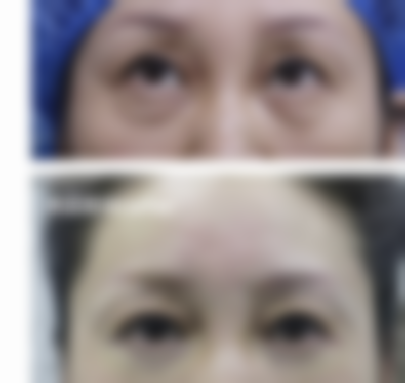 修复期护理与心理调节