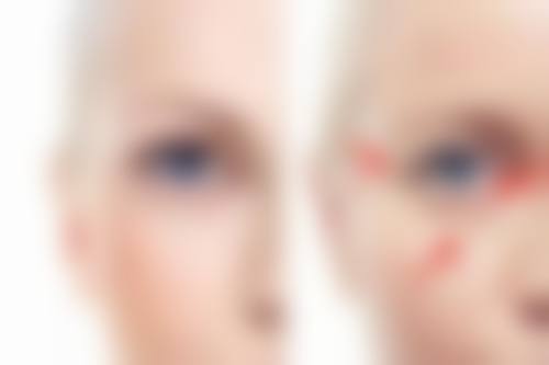 疤痕妊娠花费揭秘：术前检查与术后修复费用也不少