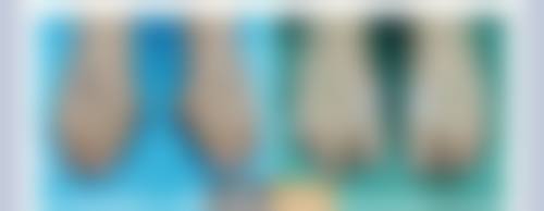 四、固镇县人民医院开展的项目：