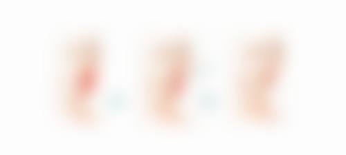 韩式双眼皮价格究竟几何？揭秘不同术式价格区间与快速恢复、自然美观优势 