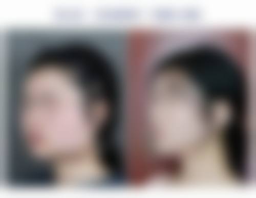 李森恺项目价格表参考