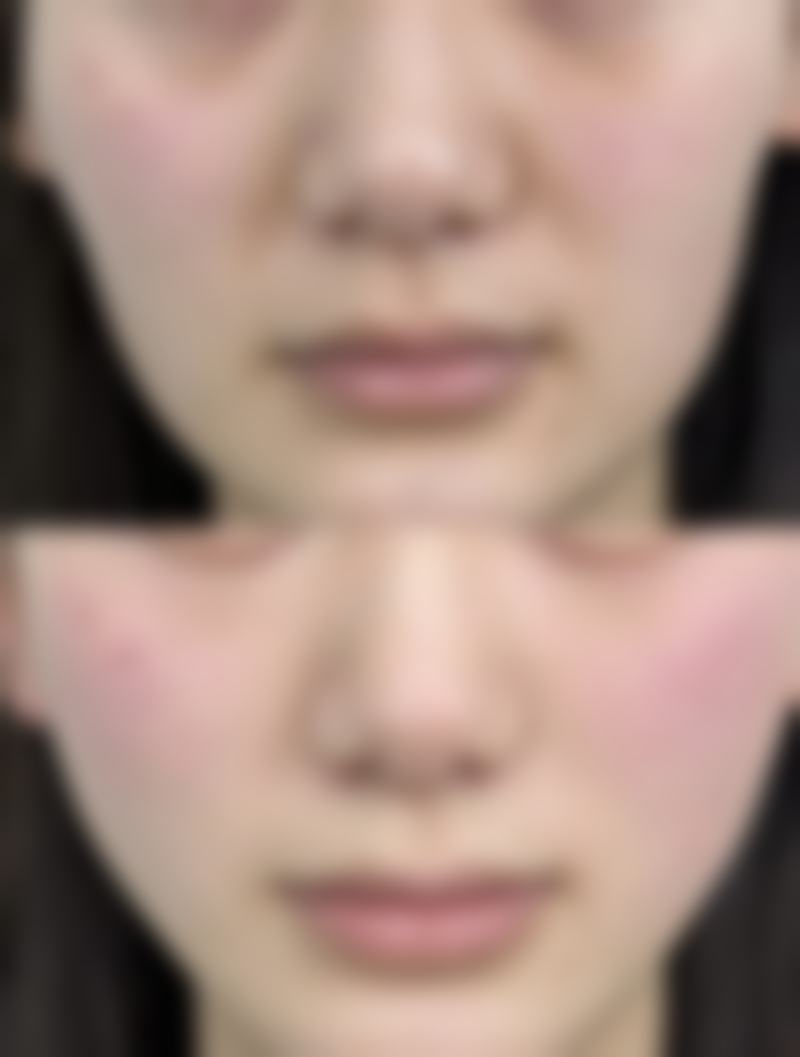 疤痕妊娠花费大揭秘：一般5000 - 20000元，多因素影响费用及医院优质诊疗服务 