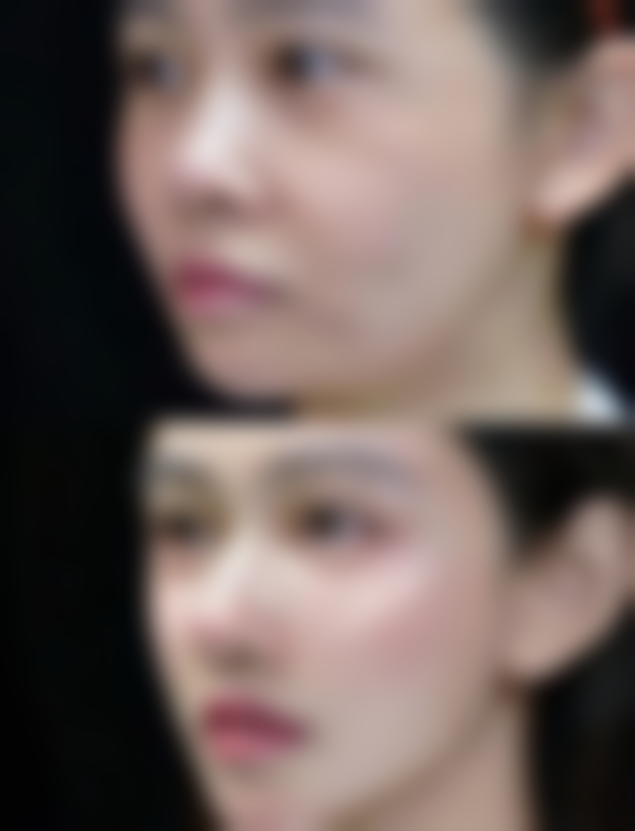 不同护理阶段，重点事项与美学成效的关联