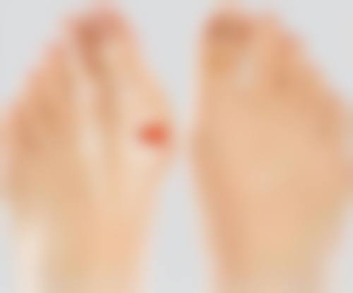 40岁女人告别眼袋困扰有妙招，非手术与手术方案结合助您重焕眼周神采 