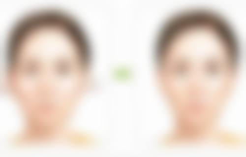 六、四川美莱整形美容医院怎么预约：