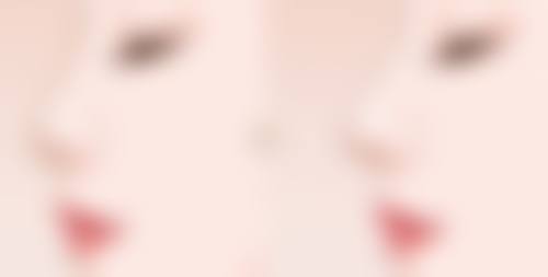 怎样极速消除眼袋？常见医美方案大揭秘