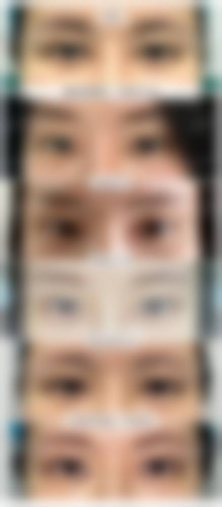 柳圣贤鼻整形水平怎么样可靠吗?