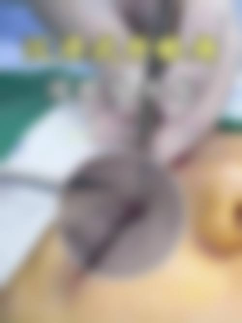 柳圣贤项目价格表参考