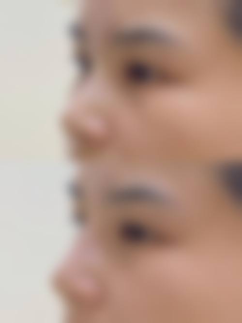 李森恺怎么预约？