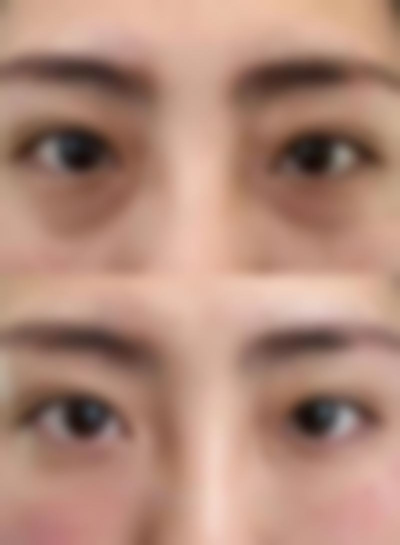 六、焦作陶子医疗美容门诊部价格表：（仅供参考）